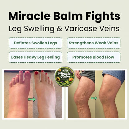 Nela™ Miracle Balm